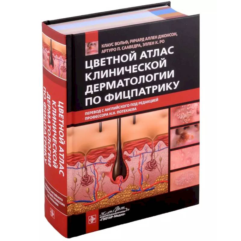 Цветной атлас клинической дерматологии по Фицпатрику Цветной атлас клинической дерматологии по Фицпатрику