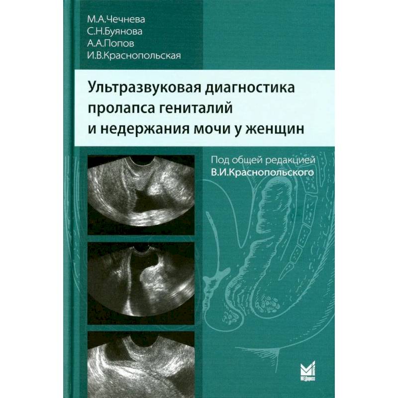 Ультразвуковая диагностика пролапса гениталий и недержания мочи у женщин Ультразвуковая диагностика пролапса гениталий и недержания мочи у женщин