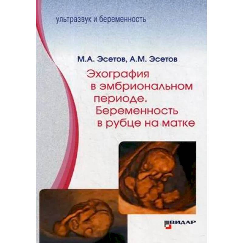 Эхография в эмбриональном периоде. Беременность в рубце на матке Эхография в эмбриональном периоде. Беременность в рубце на матке