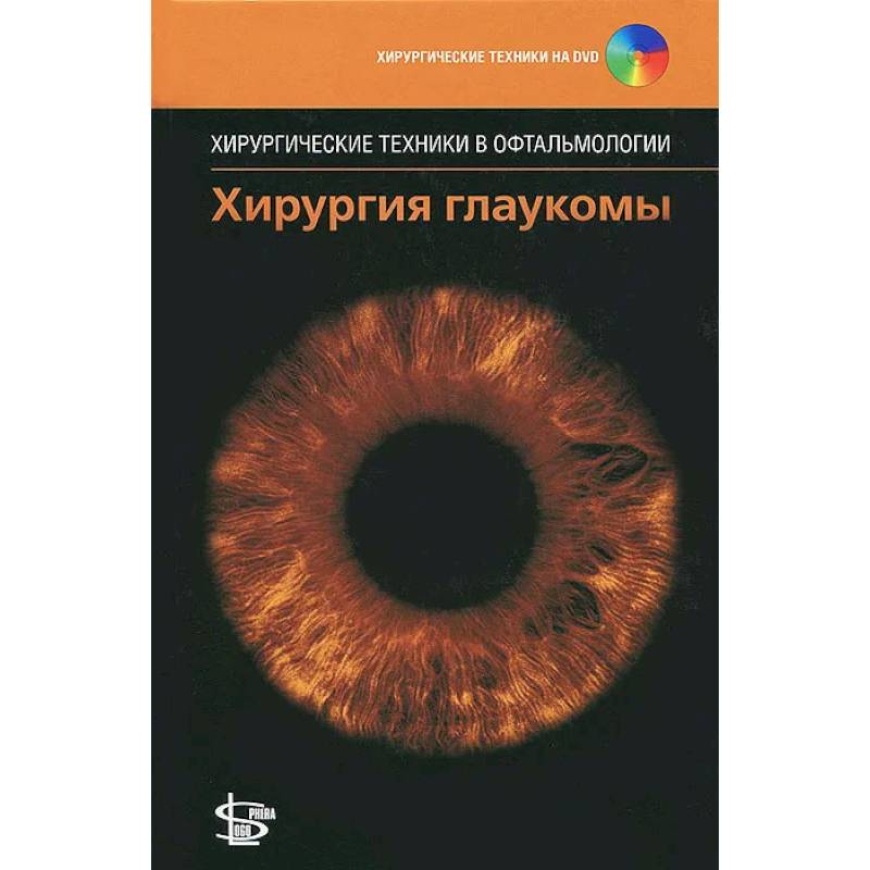 Хирургия глаукомы. + DVD Хирургия глаукомы. + DVD