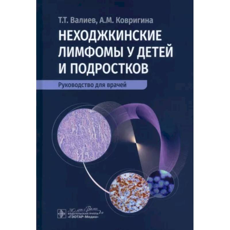 Неходжкинские лимфомы у детей и подростков Неходжкинские лимфомы у детей и подростков