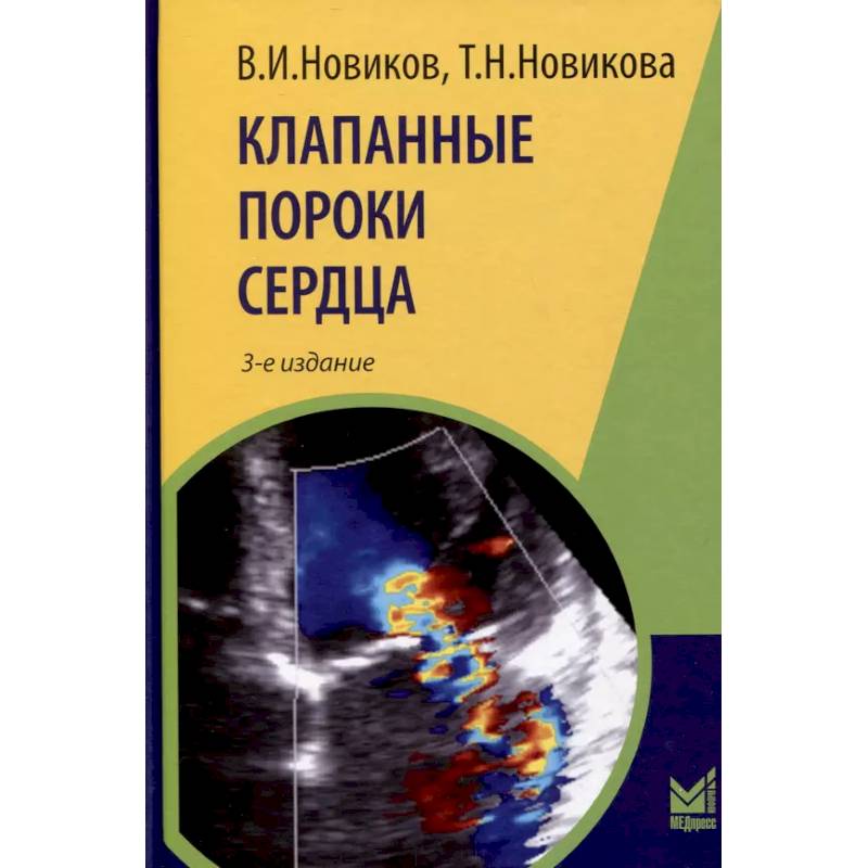 Клапанные пороки сердца Клапанные пороки сердца