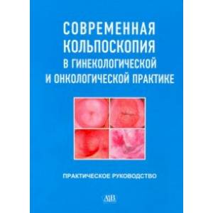 Современная кольпоскопия в гинекологической и онкологической практике Современная кольпоскопия в гинекологической и онкологической практике