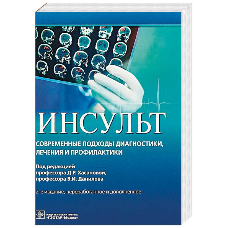 Инсульт. Современные подходы диагностики, лечения и профилактики. Методические рекомендации