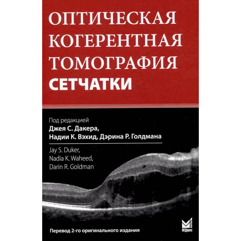 Оптическая когерентная томография сетчатки. Перевод 2-го оригинального издания Оптическая когерентная томография сетчатки. Перевод 2-го оригинального издания