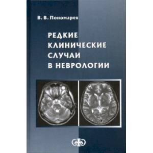 Редкие клинические случаи в неврологии (случаи из практики). Руководство для врачей Редкие клинические случаи в неврологии (случаи из практики). Руководство для врачей