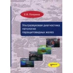 Ультразвуковая диагностика патологии паращитовидных желез Ультразвуковая диагностика патологии паращитовидных желез