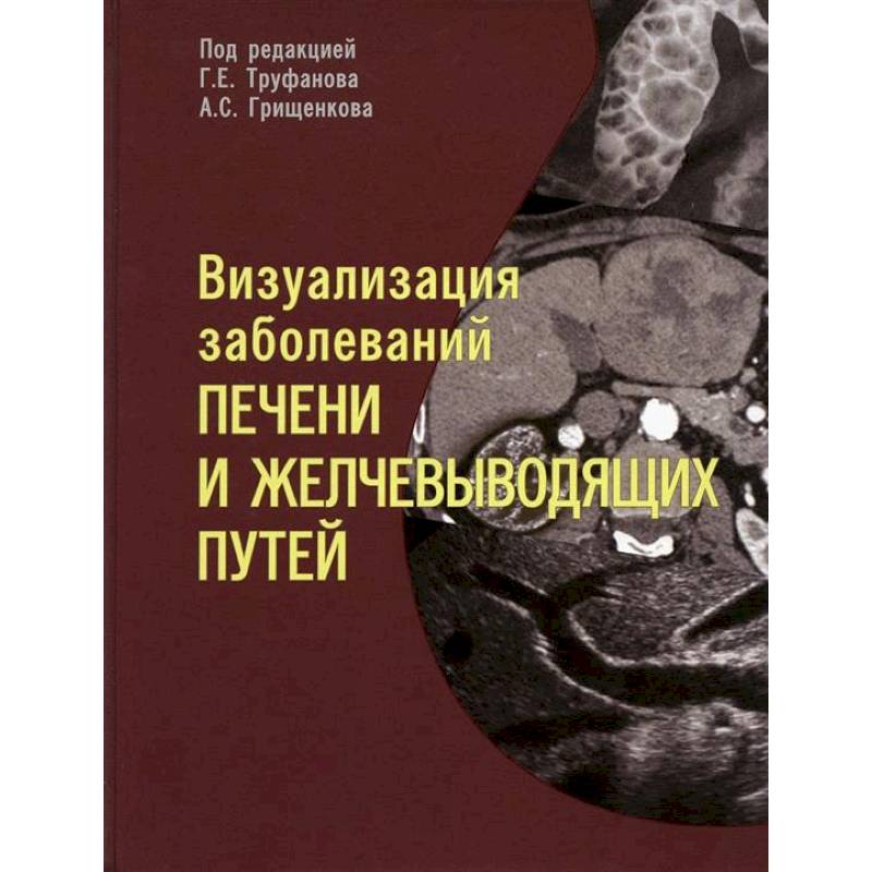 Визуализация заболевантй печени и желчевыводящих путей. Учебное пособие Визуализация заболевантй печени и желчевыводящих путей. Учебное пособие