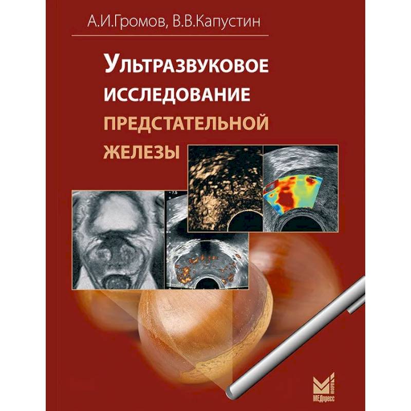 Ультразвуковое исследование предстательной железы