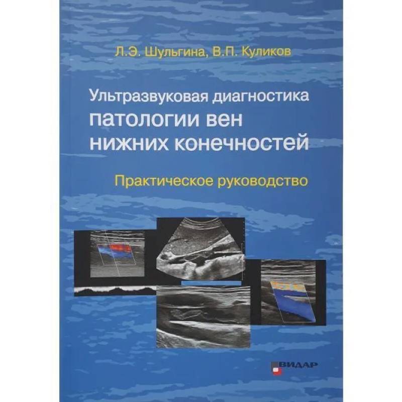 Ультразвуковая диагностика патологии вен нижних конечностей: практическое руководство Ультразвуковая диагностика патологии вен нижних конечностей: практическое руководство