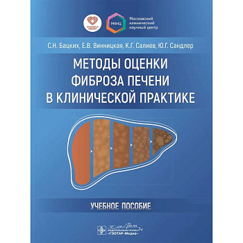 Методы оценки фиброза печени в клинической практике