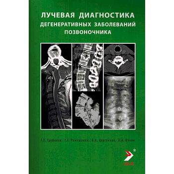 Лучевая диагностика дегенеративных заболеваний позвоночника