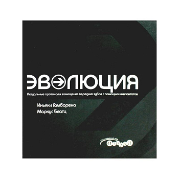 Актуальные протоколы замещения передних зубов с помощью имплантатов