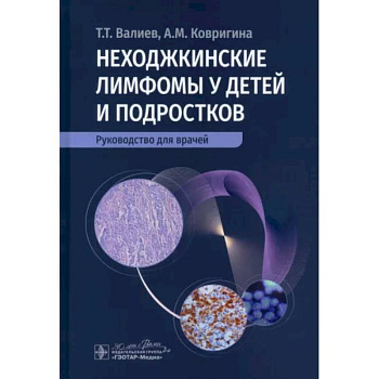Неходжкинские лимфомы у детей и подростков Неходжкинские лимфомы у детей и подростков