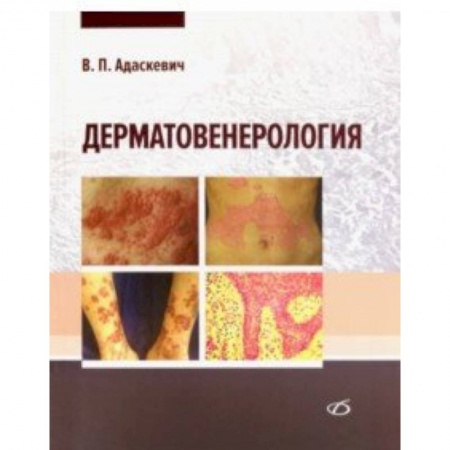 Кожные и венерические болезни, книга Дерматовенерология купить по скидке