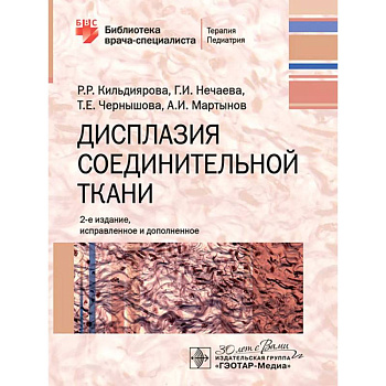 Дисплазия соединительной ткани Дисплазия соединительной ткани